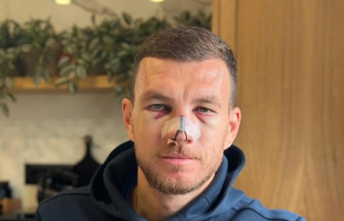 Edin Džeko