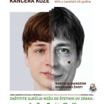 Dermatološki pregled / Foto/ SKB Mostar