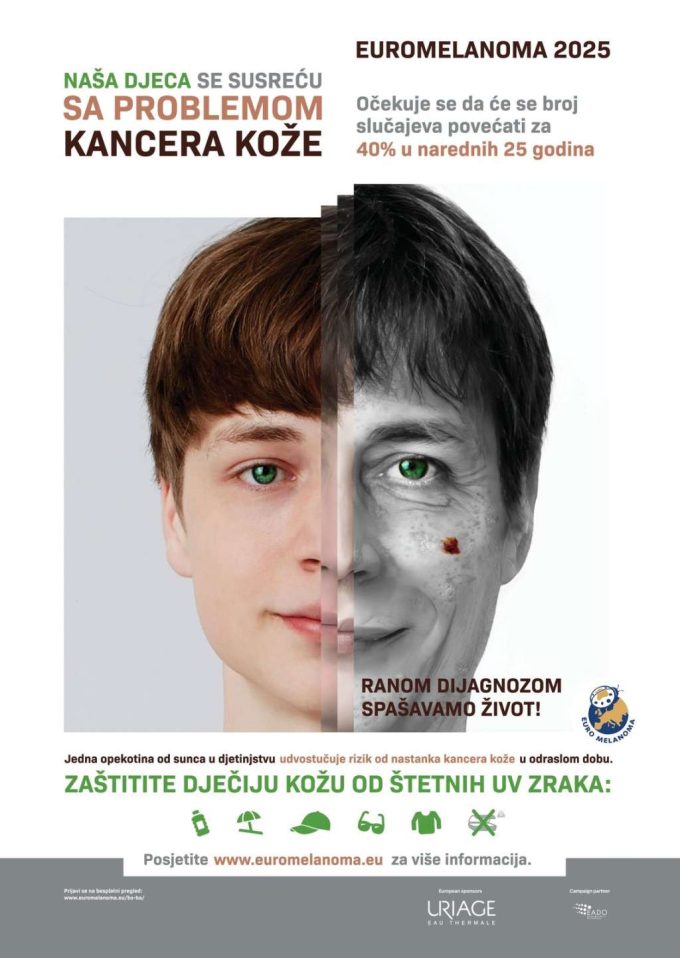 Dermatološki pregled / Foto/ SKB Mostar