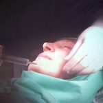 Estetske operacija / Foto: Agencija