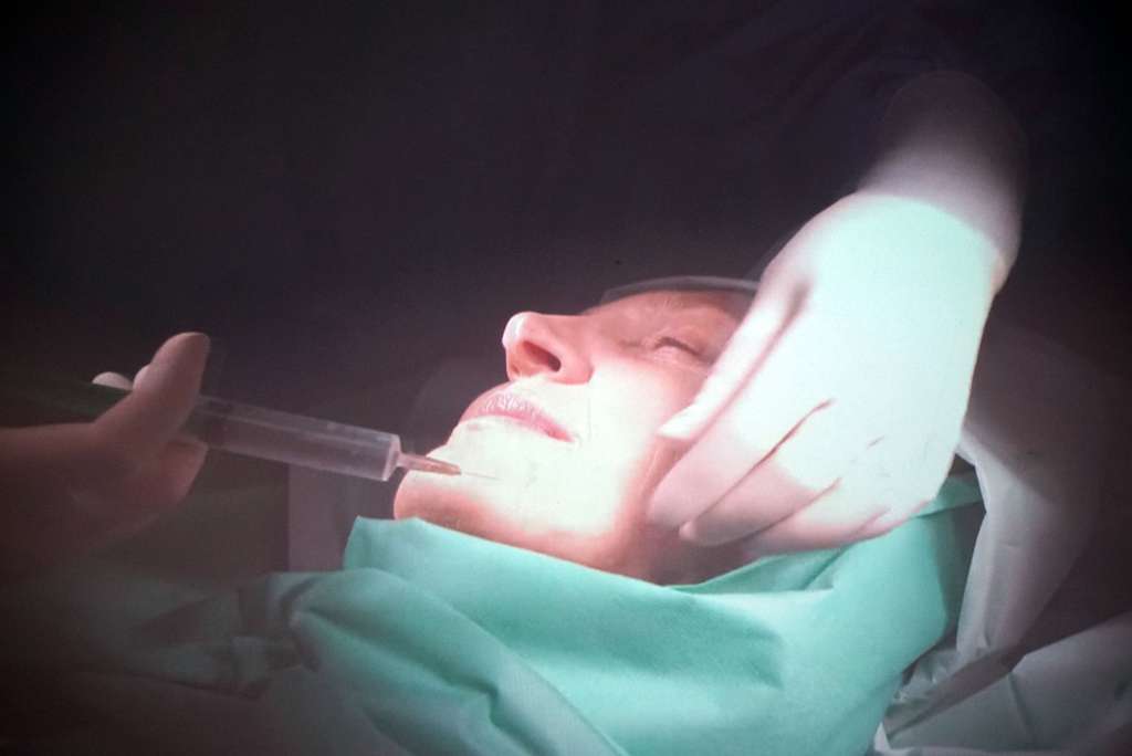 Estetske operacija / Foto: Agencija