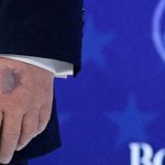 trumpove ruke