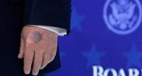 trumpove ruke