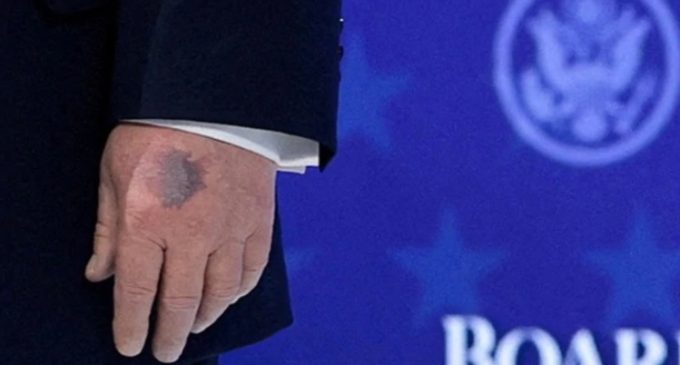 trumpove ruke